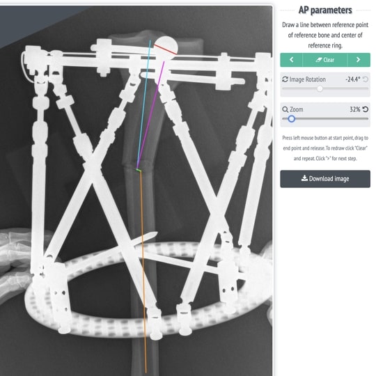 Measurement on x-ray image